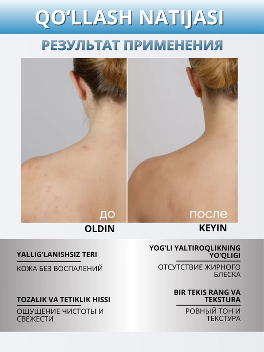 ICON SKIN yog‘li, muammoli teri uchun salitsil kislotali yuz va tana uchun tozalovchi gel