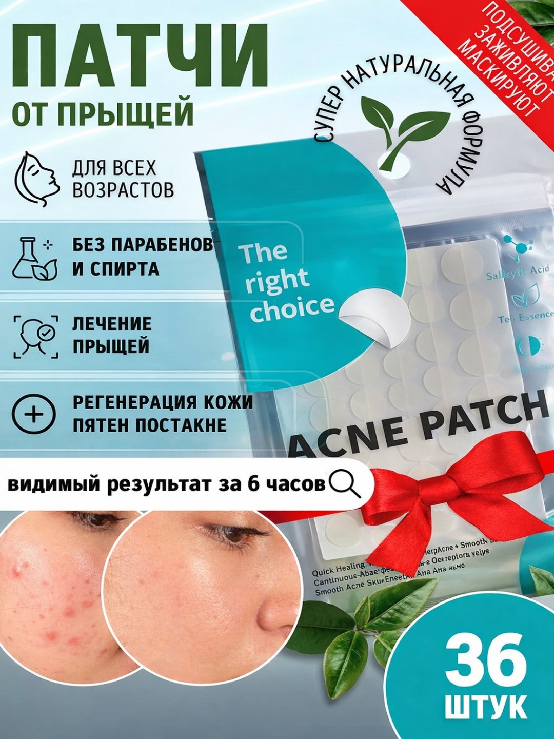 Yuz uchun akne va yiringli ugrilarga qarshi ta'sir etuvchi patchlar, 36 dona - 