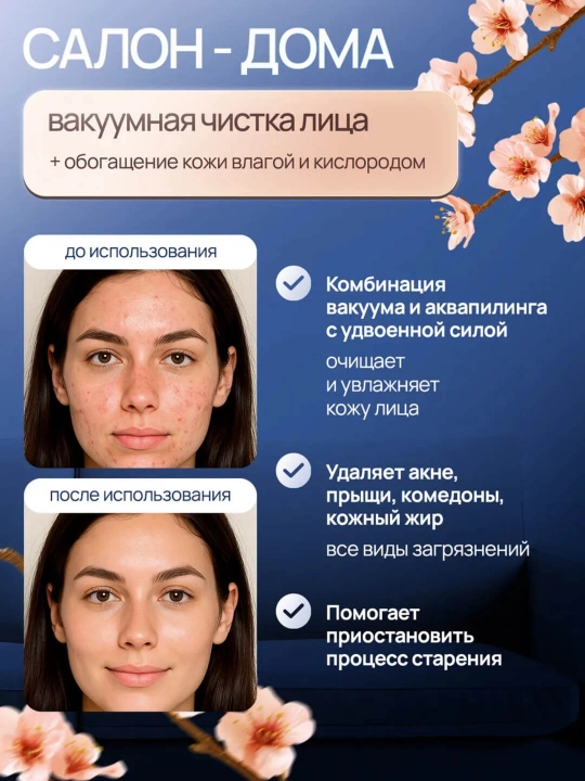 Вакуумный очиститель кожи с аквапилингом – от чёрных точек и загрязнений, 6 насадок