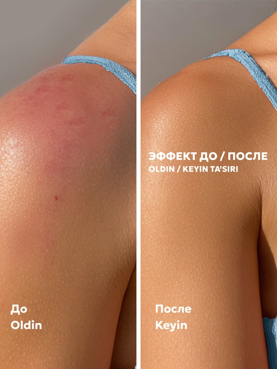 SPF 30 va 50 darajadagi tana uchun quyoshdan himoyalovchi krem