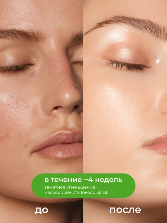 GARNIER Skin Naturals Сыворотка для лица «Чистая кожа», 30 мл