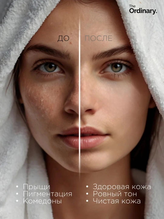 Сыворотка для лица The Ordinary Niacinamide 10% + Zinc 1%, 30 мл