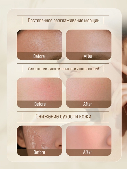 Увлажняющий крем с астрагалом, 50 г, для восстановления чувствительной кожи