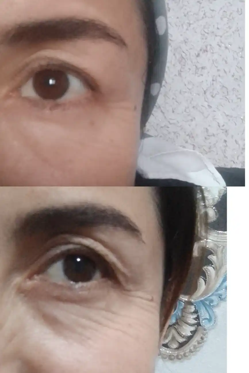 Yuzni tortuvchi krem va mustahkamlovchi zardob retinol bilan, Celimax