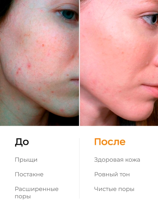 LIKATO PROFESSIONAL sezgir terini tozalash uchun ferment kukuni