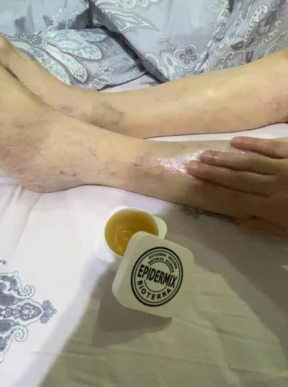 Maz - Malham Bioterra Epidermix NAFTALAN bilan 50ML