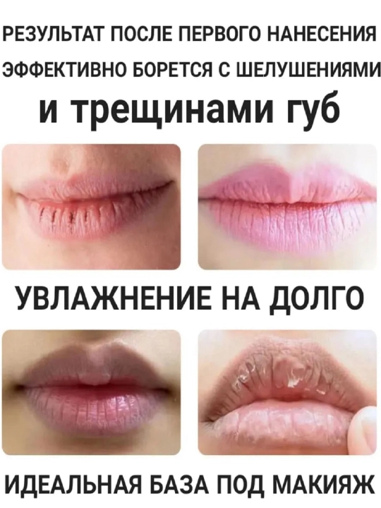 Бальзам для губ, гигиенический, от трещин и для сухой кожи, Blistex, SPF 15