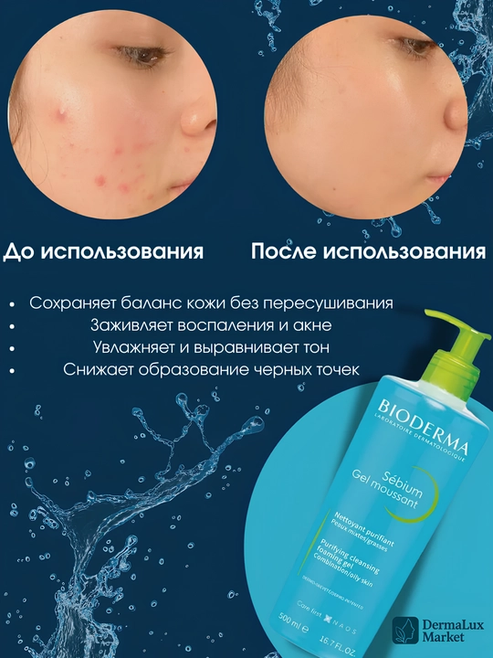 Очищающий гель для жирной кожи, против акне и чёрных точек – Sébium Gel Moussant, 500 мл