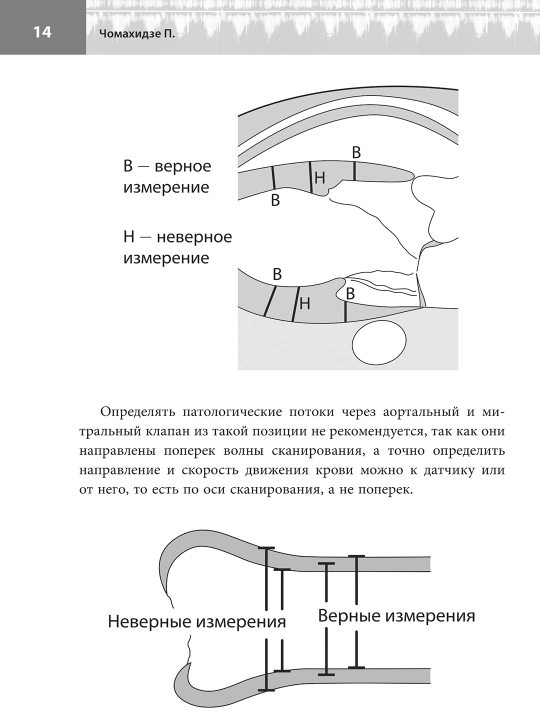 Эхокг Для Начинающих