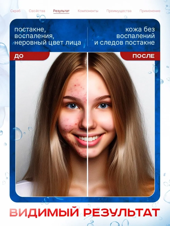 Yuz uchun soda skrabi, Etude, Baking Powder, 200 ml