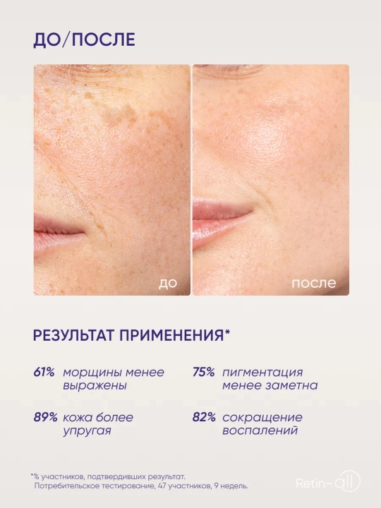 Крем для лица ICON SKIN Retin-All с ретинолом, антивозрастной, против морщин, 30 мл