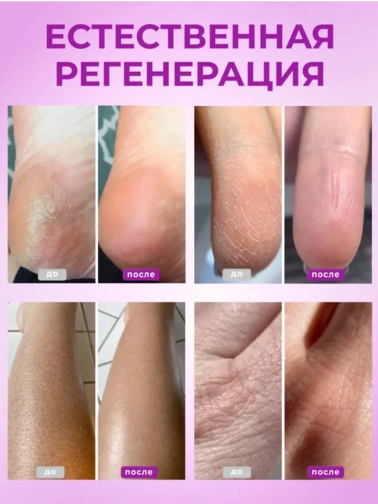 Oyoq va qo‘llar uchun AYA mumli krem, yoriqlarga qarshi, mochevina  tovonlar yumshatuvchi