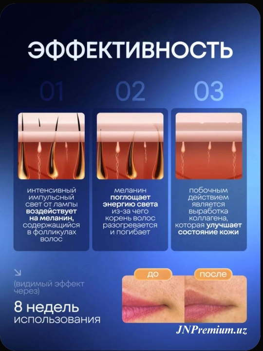 Babyverse Professional fotoepilyator, yuz va tana uchun, sovutish effektiga ega