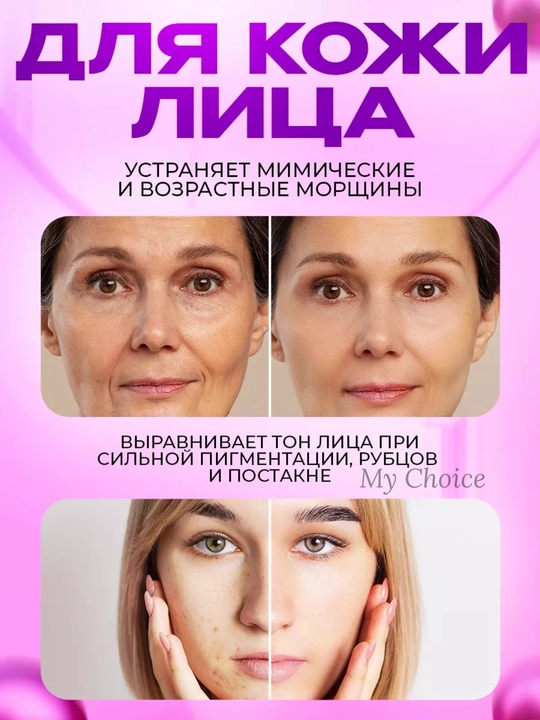 Мезороллер для лица и тела 0,5–2 мм для роста волос и обновления кожи