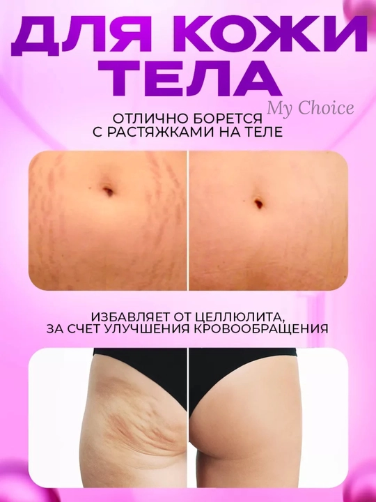 Мезороллер для лица и тела 0,5–2 мм для роста волос и обновления кожи