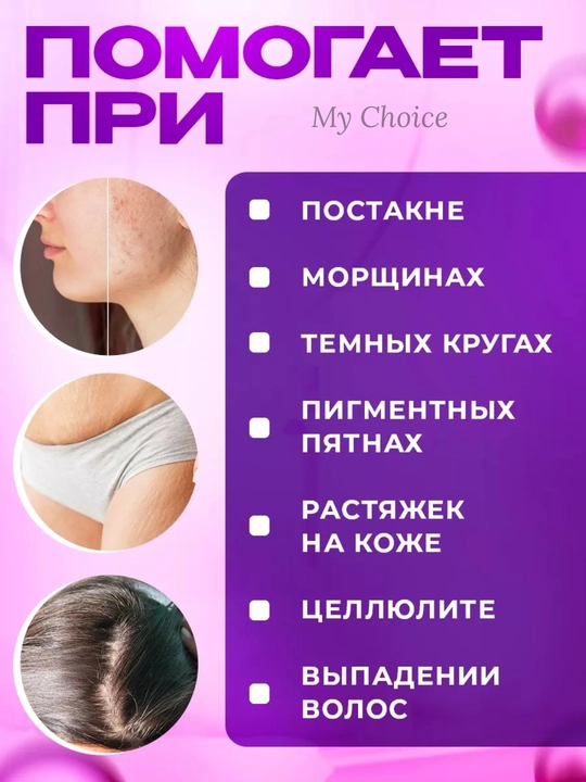 Мезороллер для лица и тела 0,5–2 мм для роста волос и обновления кожи