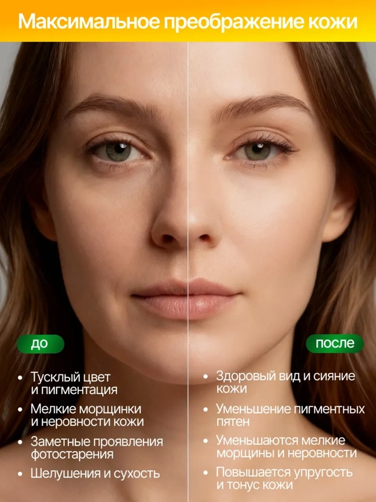 Крем-филлер для кожи вокруг глаз C-VIT PRO Age Therapy против морщин, 15 мл, Dilis