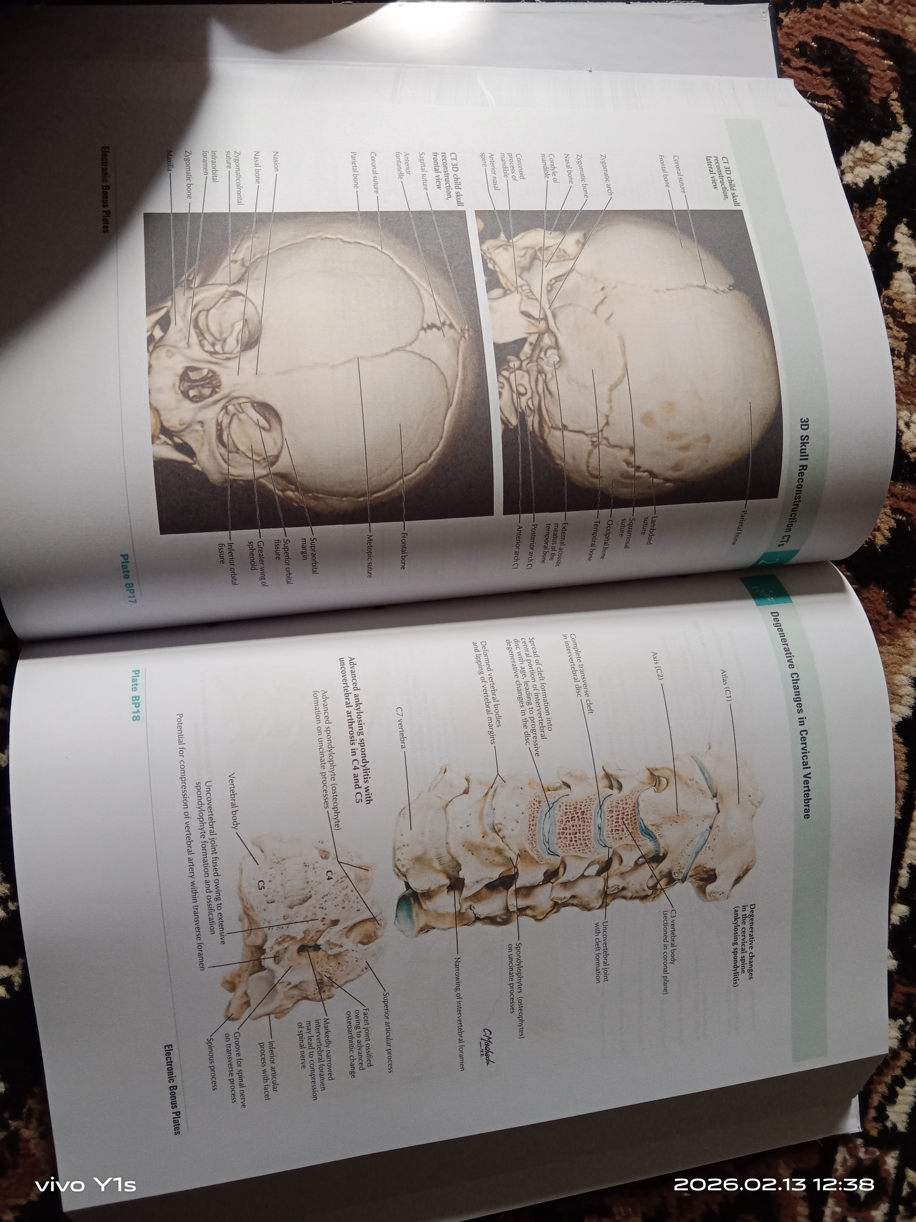 Tibbiyot kitobi, odam anatomiyasi atlasi, ATLAS OF HUMAN ANATOMY, Frank Netter