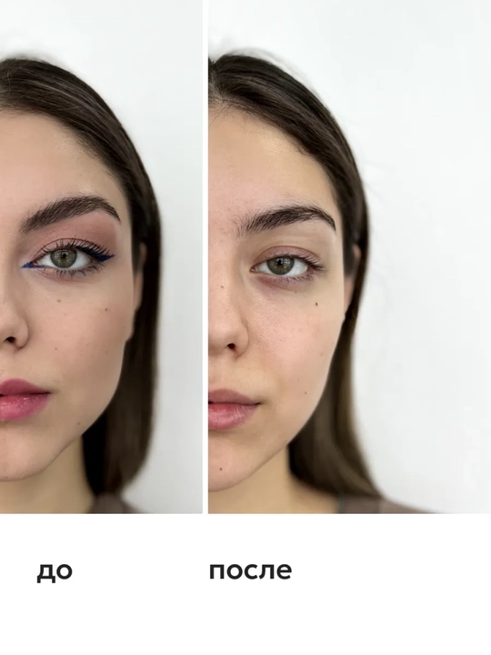 Мицеллярная вода для лица Likato Professional, с гиалуроновой кислотой, 250 мл