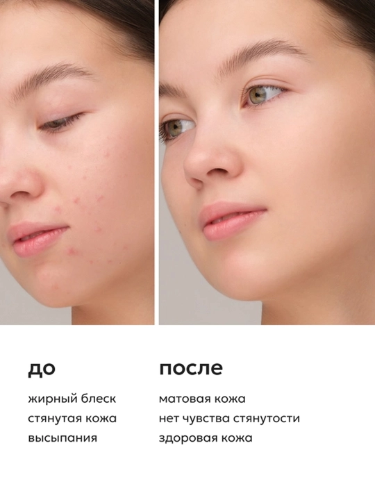 Гель для умывания Likato Professional, с aha-кислотами, 250 мл