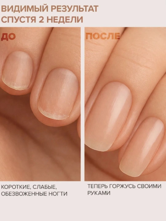 FRENCHI Умная Эмаль, Лак ногтей Стимулятор ускоренного роста медленно растущих ногтей  11мл