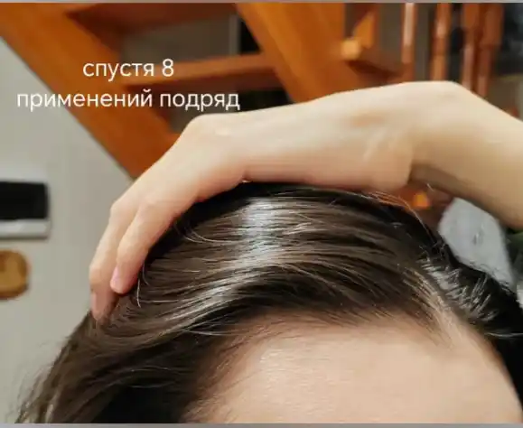Soch va soqol o'stirish uchun rozmarin yog'i AYA, to'kilishiga qarshi serum, 30 ml