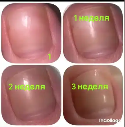 Масло монарды AYA усиленное + масло чайного дерева, экстракт для ногтей и  кутикулы, 30 мл