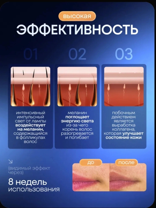 Фотоэпилятор профессиональный, для лица и тела, с эффектом охлаждения
