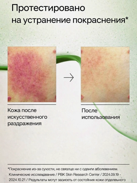 Anua Azelaic Acid 10% Hyaluron успокаивающая сыворотка против акне, 30 мл
