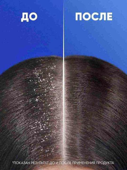 Head&shoulders шампунь "Питательный уход", 400 мл