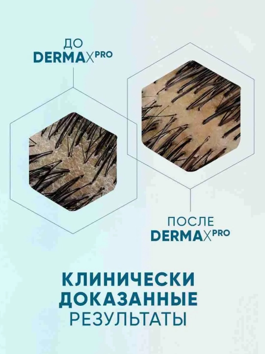 HEAD&SHOULDERS шампунь Derma Xpro, успокаивающий, комфорт, 270 мл
