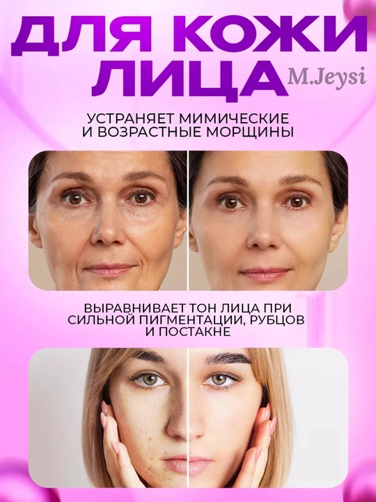 Мезороллер для лица и тела 0,5–2 мм , для роста волос и обновления кожи