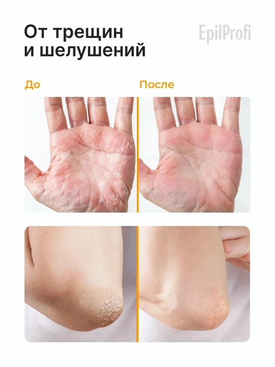 Tana uchun krem EpilProfi, yoriqlarga qarshi, 100 ml