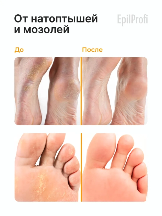 Tana uchun krem EpilProfi, yoriqlarga qarshi, 100 ml
