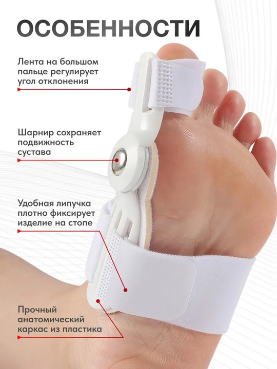 Valgus shinasi, bosh barmoq fiksator-korrektori, Hallux Valgusda oyoq fiksatori