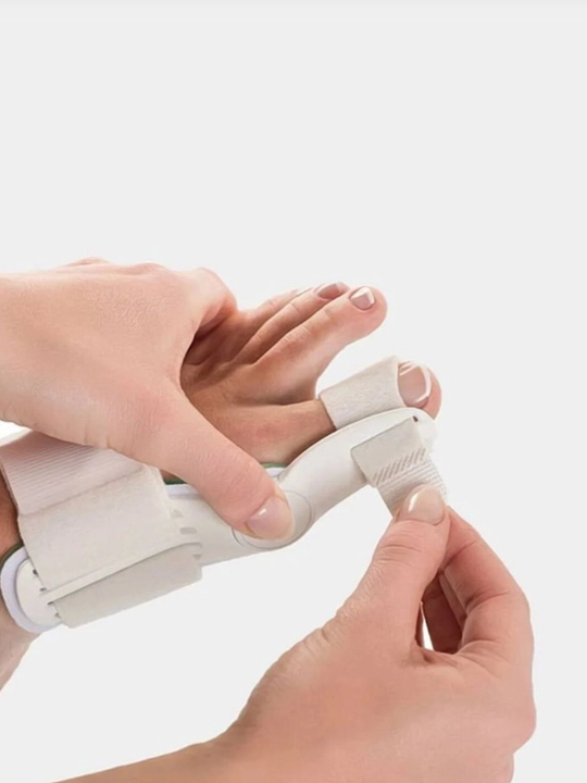 Valgus shinasi, bosh barmoq fiksator-korrektori, Hallux Valgusda oyoq fiksatori
