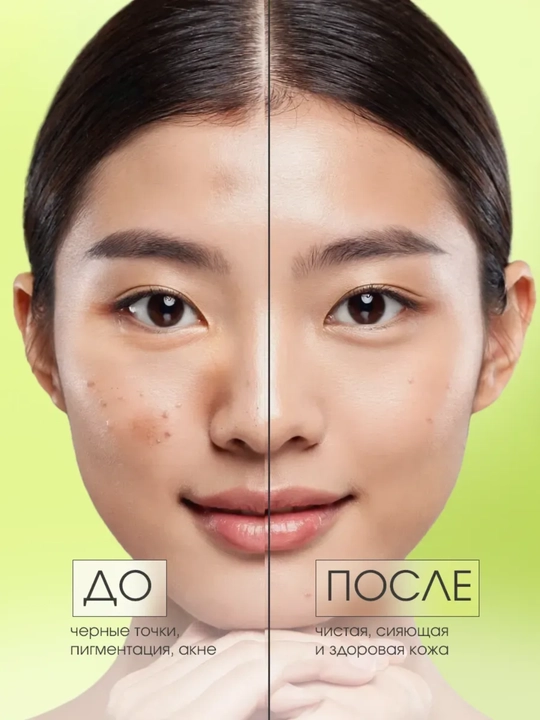 Yuz uchun tozalovchi loy niqobi, Celimax, Noni clay mask, 120 ml