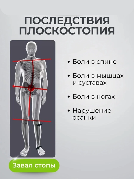 Гелевые вкладыши для обуви , пелоты для поддержки свода,  стопы и против скольжения