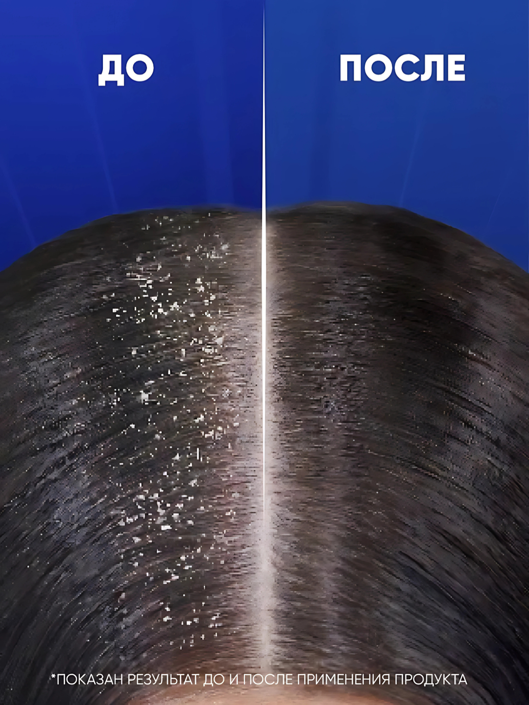 Head & Shoulders Шампунь Цитрусовая свежесть 200 мл