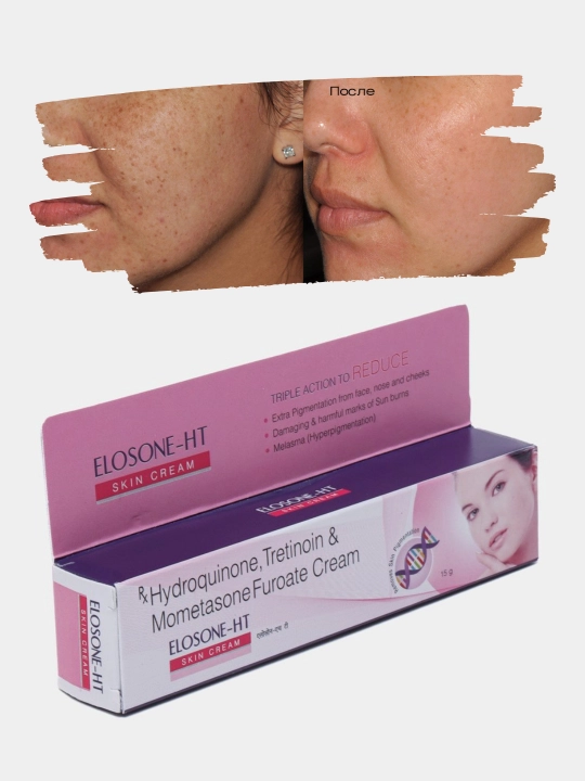 Yuz uchun oqartiruvchi krem Elosone -HT, dog'lar, akne va ajinlar uchun, 15 g