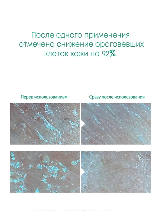 Гель-пенка для умывания Anua Heartleaf Succinic Moisture Cleansing Foam
