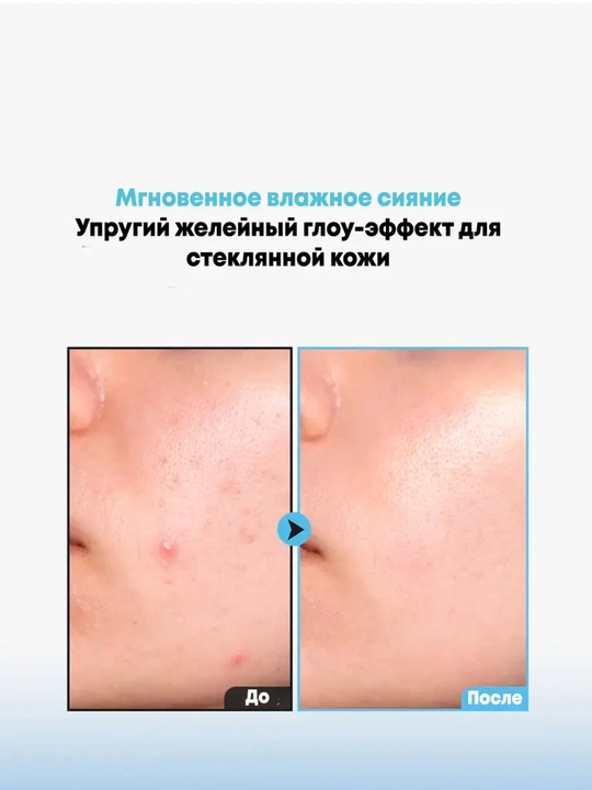 Namlovchi mist jele teksturasi bilan Dr.Althea Aqua Marine Jelly Mist