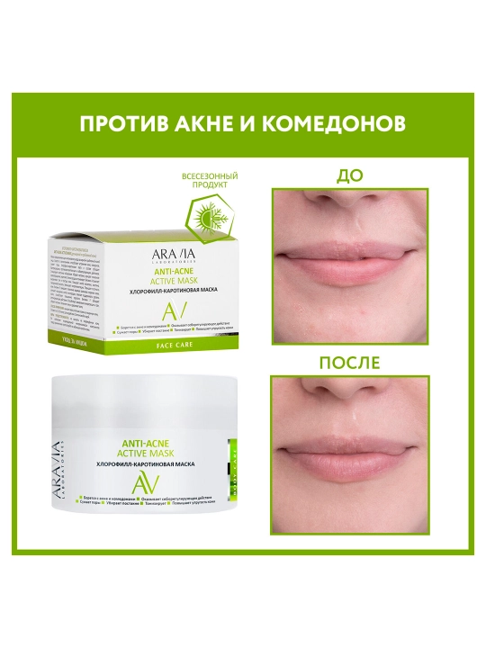 Маска Для Лица Aravia Lab Anti-acne Active Mask, Хлорофилл-каротиновая, 150 Мл