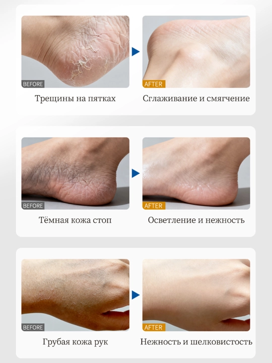 Крем мазь для пяток, рук, ног, лица, увлажняет и заживляет трещин на коже, 30 гр