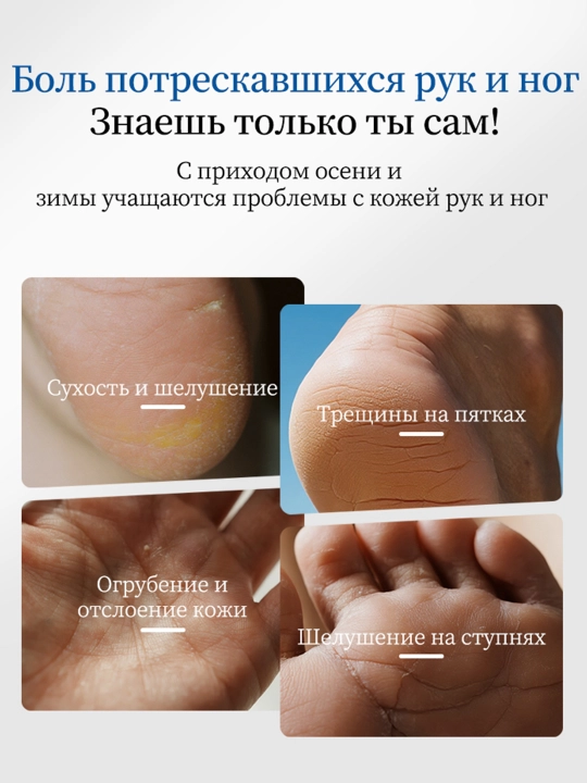 Крем мазь для пяток, рук, ног, лица, увлажняет и заживляет трещин на коже, 30 гр