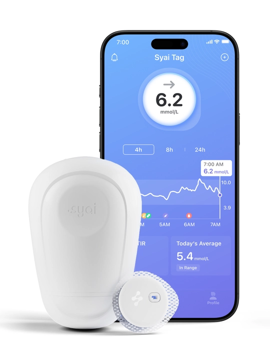SYAI - Glyukozani uzluksiz monitoring qilish tizimi (CGM)