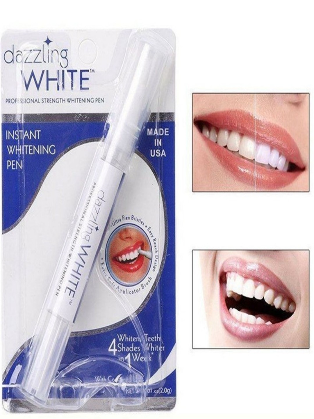 Ручка для отбеливания зубов Dazzling White - 