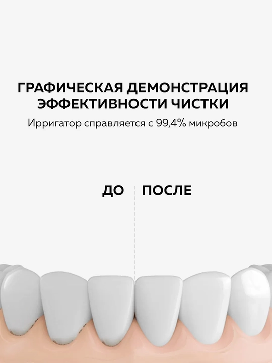 Ирригатор для полости рта Xiaomi Mijia Water Flosser 2, беспроводной портативный, 200 мл
