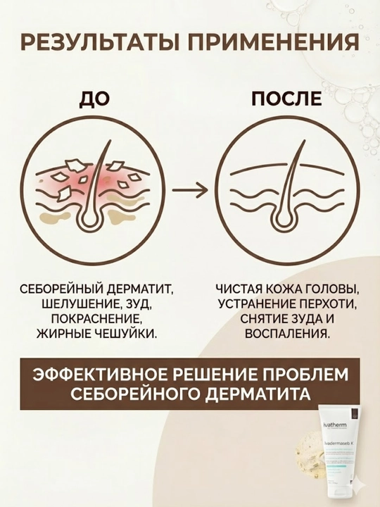 Ivatherm IVADERMASEB K Керато-снижающий шампунь, 200 мл