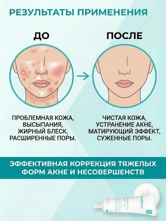 Ivatherm Ivapur A.l. АКНЕ-SYT Крем для жирной кожи с выраженными несовершенствами 30 мл